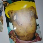 Ikechukwu Amadi. Murdered by sars after being tortured, fed and bathed acid August 2020